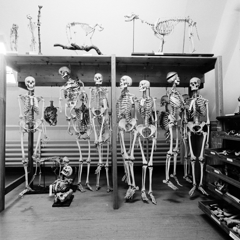 Bild aus der Arbeit „Humankapital“ von Florian Albrecht-Schoeck.